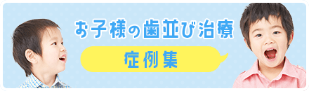 お子様の歯並び治療症例集